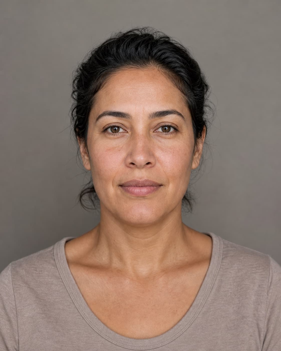 Synthetic portrait demonstrating a subtle illustrative Botox simulation, source portrait