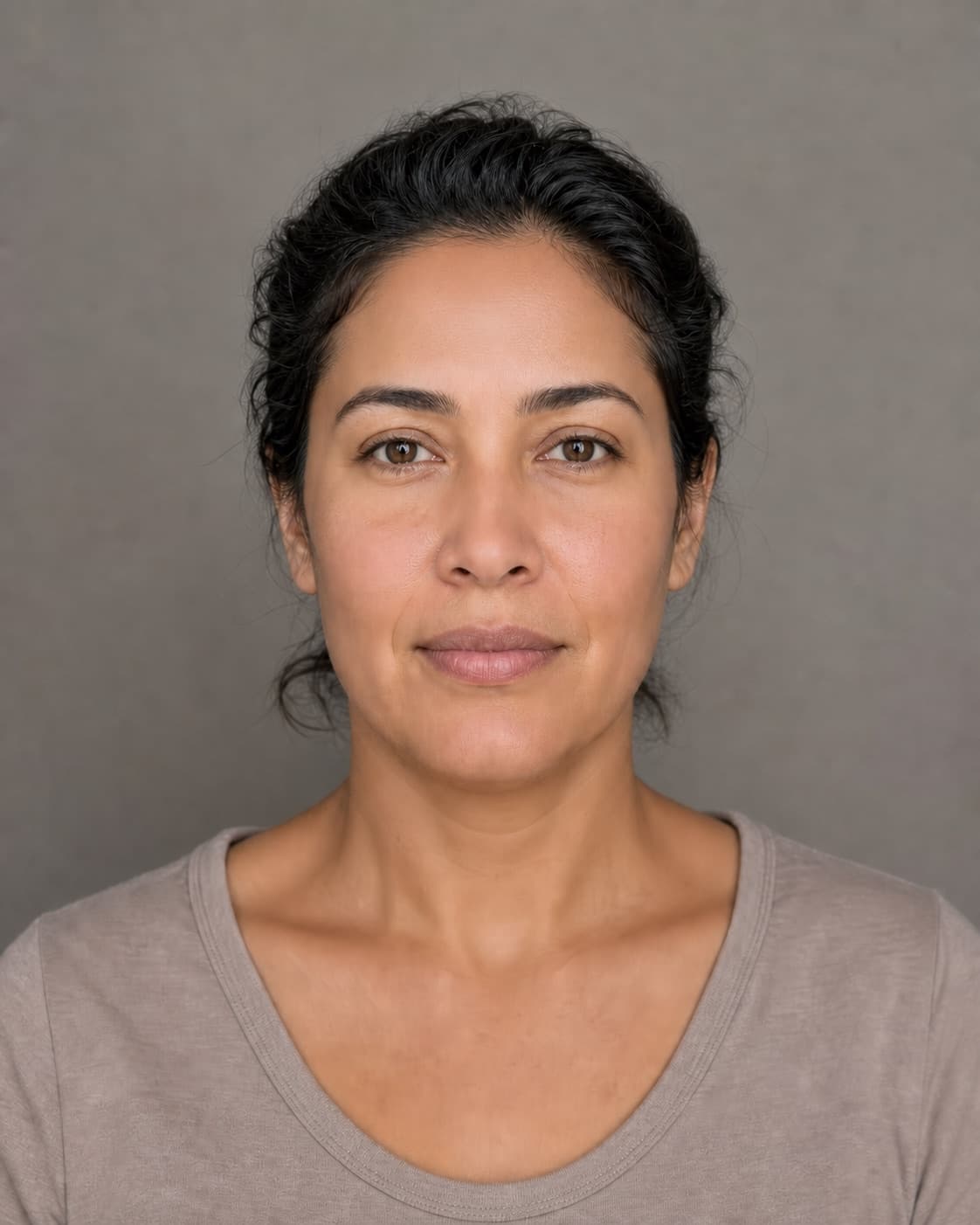 Synthetic portrait demonstrating a subtle illustrative Botox simulation, simulated preview
